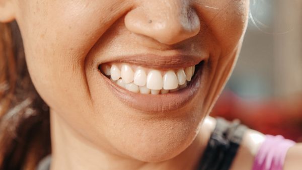 Después del tratamiento dental