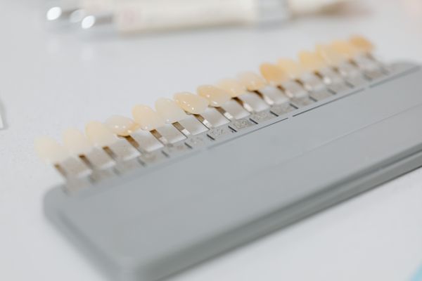 Blanqueamiento dental